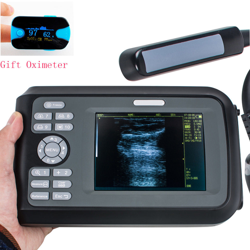 USA Veterinary ultrasound Machine scanner Animal Rectal Probe+ Oximeter +Battery DIAGNOSTIC ULTRASOUND MACHINES FOR SALE