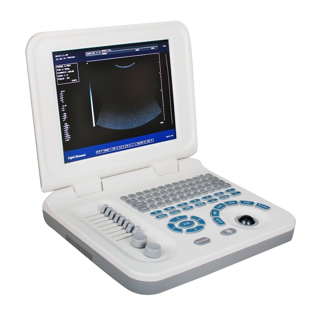 10" Portable Ultrasound Scanner Machine Micro-Convex Probe With Bag and Battery DIAGNOSTIC ULTRASOUND MACHINES FOR SALE