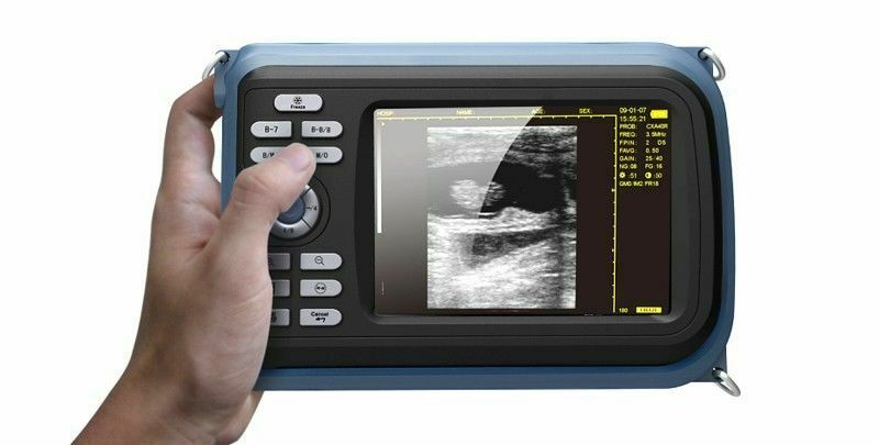 5.5'' Digital Ultrasound Scanner Machine With R40 3.5Mhz Convex Probe Human Use DIAGNOSTIC ULTRASOUND MACHINES FOR SALE