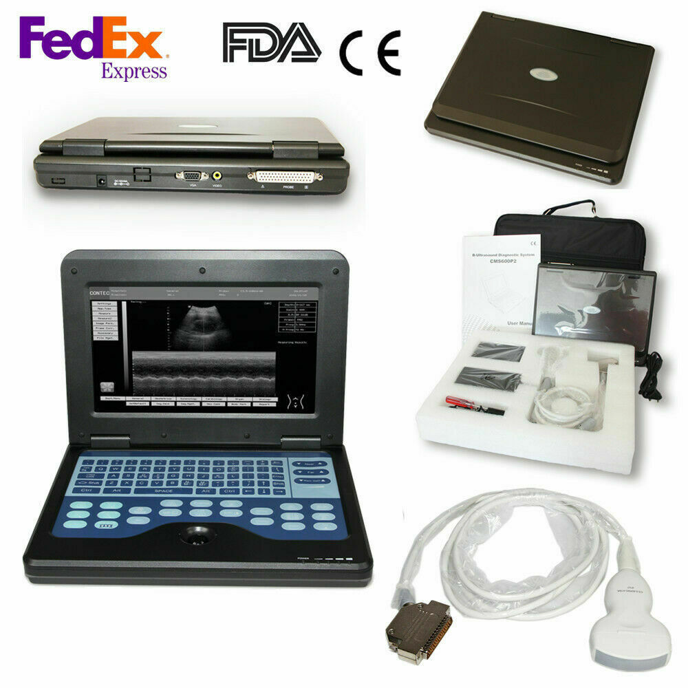 USA Digital Ultrasound Scanner Portable Laptop Ultrasound Machine+Convex Probe DIAGNOSTIC ULTRASOUND MACHINES FOR SALE