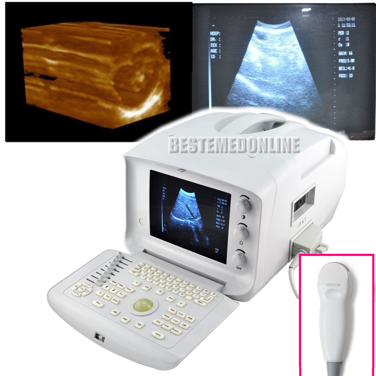 Ultrasound Scanner Micro-Convex Probe  Ultrasonic Machine 3D Ultrasound Unit DIAGNOSTIC ULTRASOUND MACHINES FOR SALE