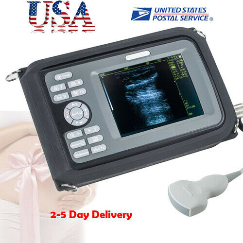 Handscan Ultrasound Scanner Machine Digital For Human Use 3.5Mhz Convex Probe US DIAGNOSTIC ULTRASOUND MACHINES FOR SALE