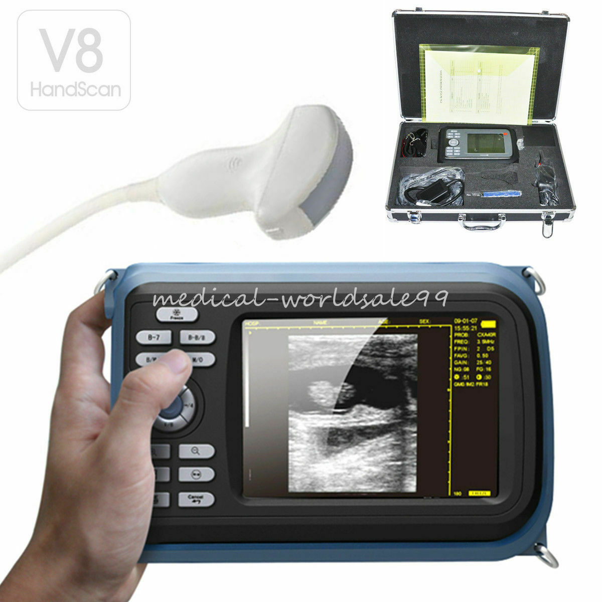 5.5'' Digital Ultrasound Scanner Machine With R40 3.5Mhz Convex Probe Human Use DIAGNOSTIC ULTRASOUND MACHINES FOR SALE