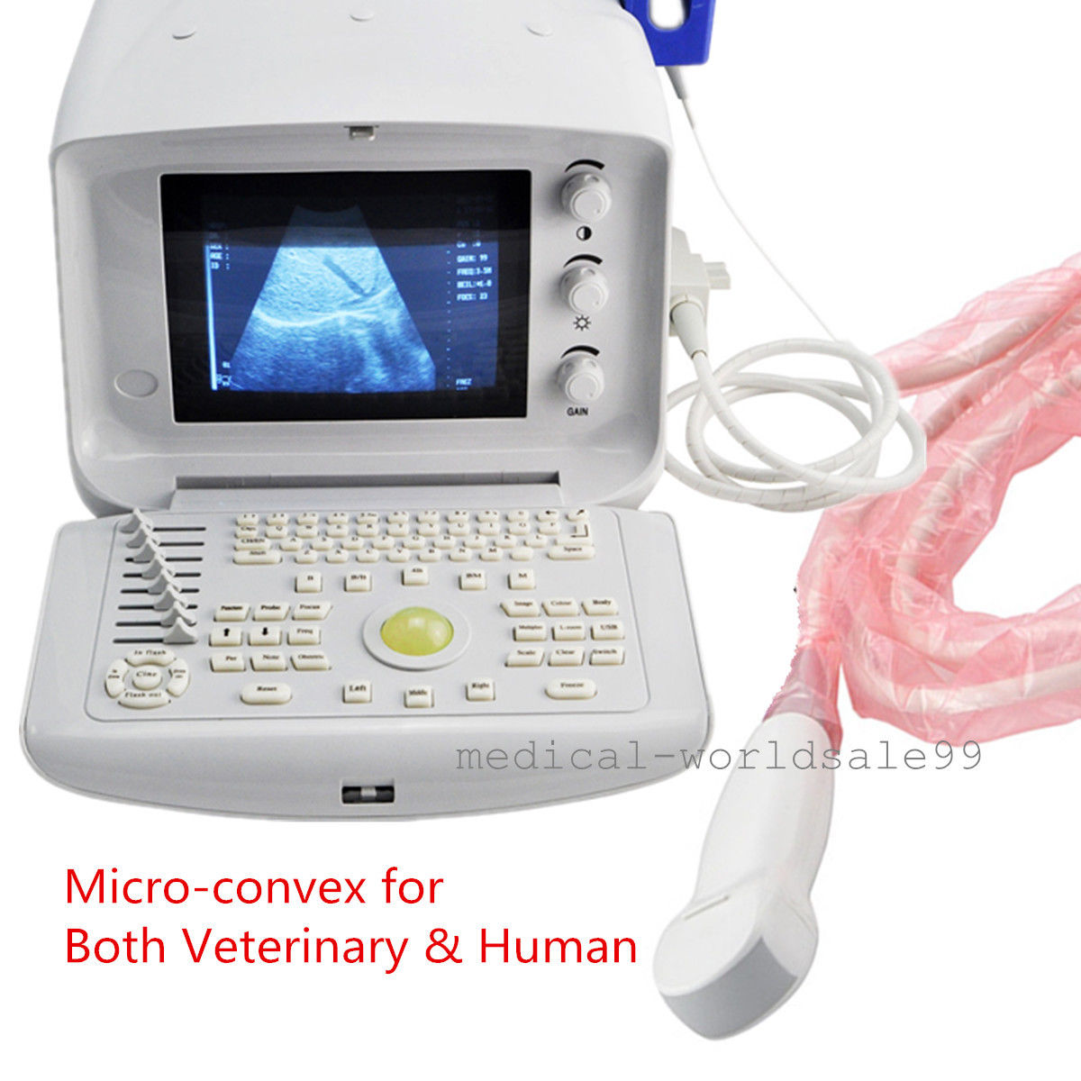 Ultrasound Scanner/Machine Micro-Convex Probe/Transducer 3D Ultrasound Scan 190891773746 DIAGNOSTIC ULTRASOUND MACHINES FOR SALE