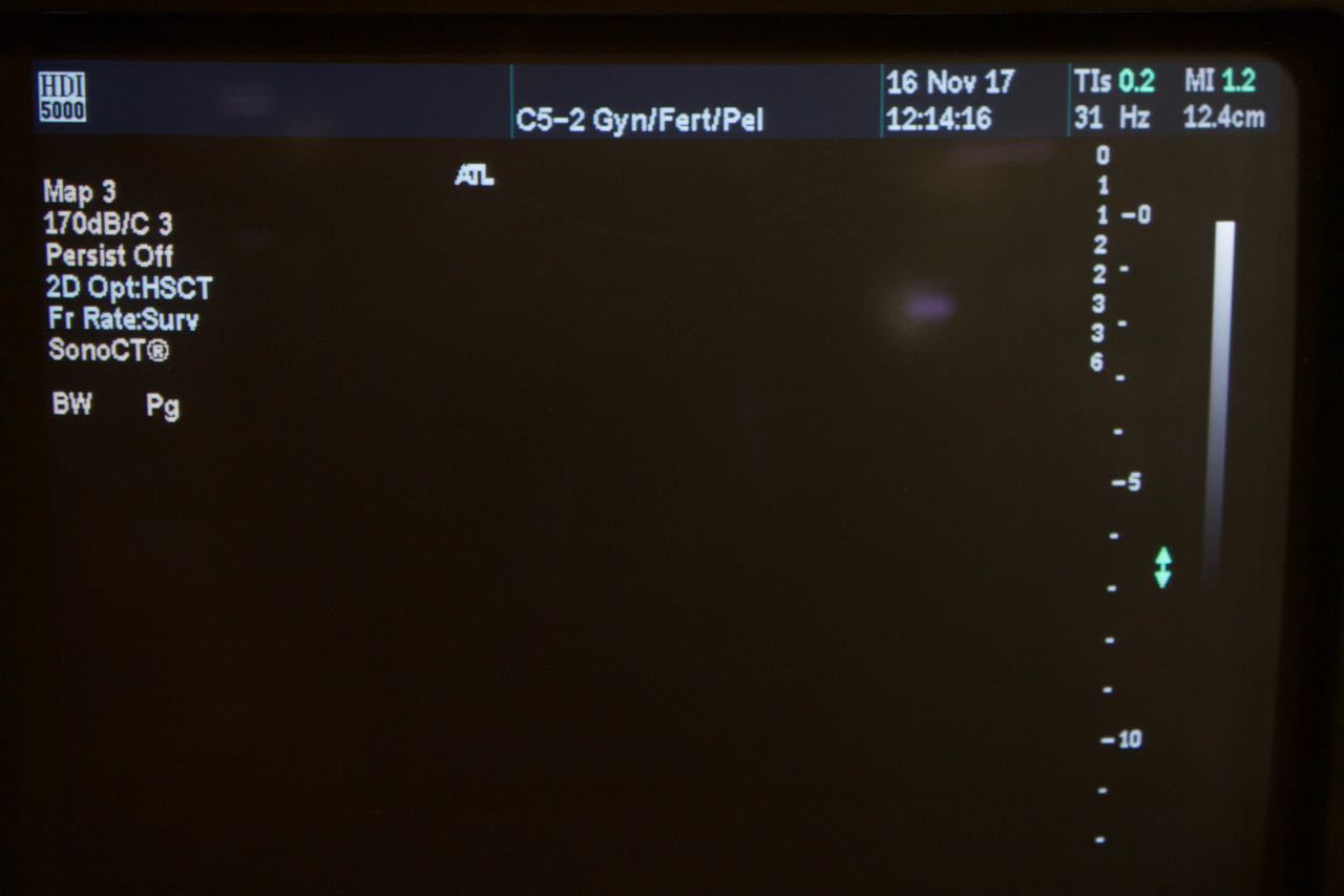Philips ATL C5-2 40R Curved Array Ultrasound Transducer HDI5000 4000-0574-05 DIAGNOSTIC ULTRASOUND MACHINES FOR SALE