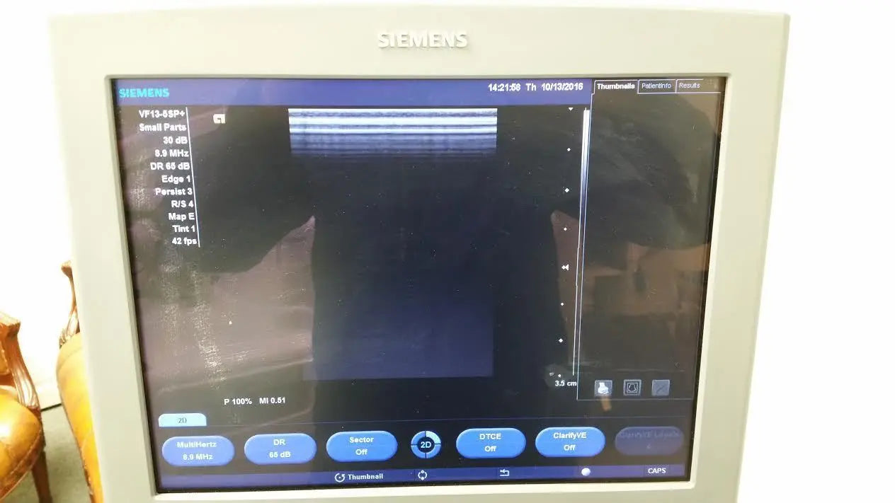 Siemens Acuson X300 Premium Ultrasound Machine. DIAGNOSTIC ULTRASOUND MACHINES FOR SALE