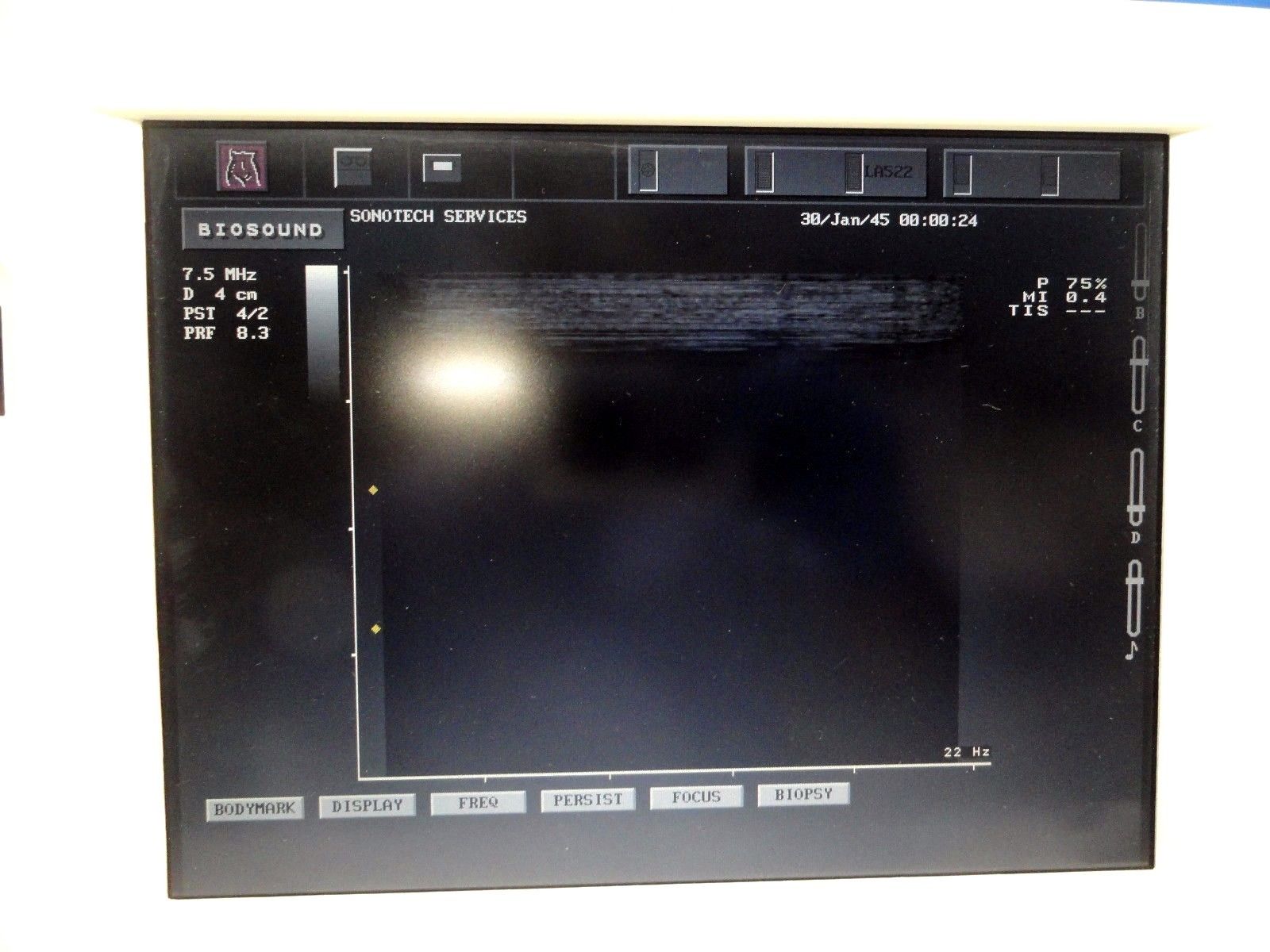 ESAOTE Biosound LA522E Linear Array Ultrasound Probe for MyLab Series ~12899 DIAGNOSTIC ULTRASOUND MACHINES FOR SALE