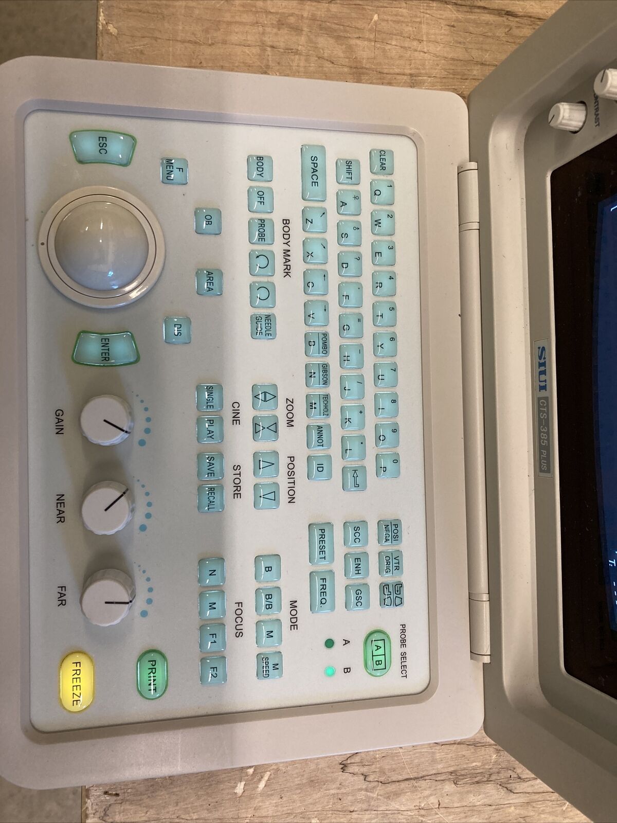 SIUI Portable Ultrasound Model CTS-385 PLUS DIAGNOSTIC ULTRASOUND MACHINES FOR SALE