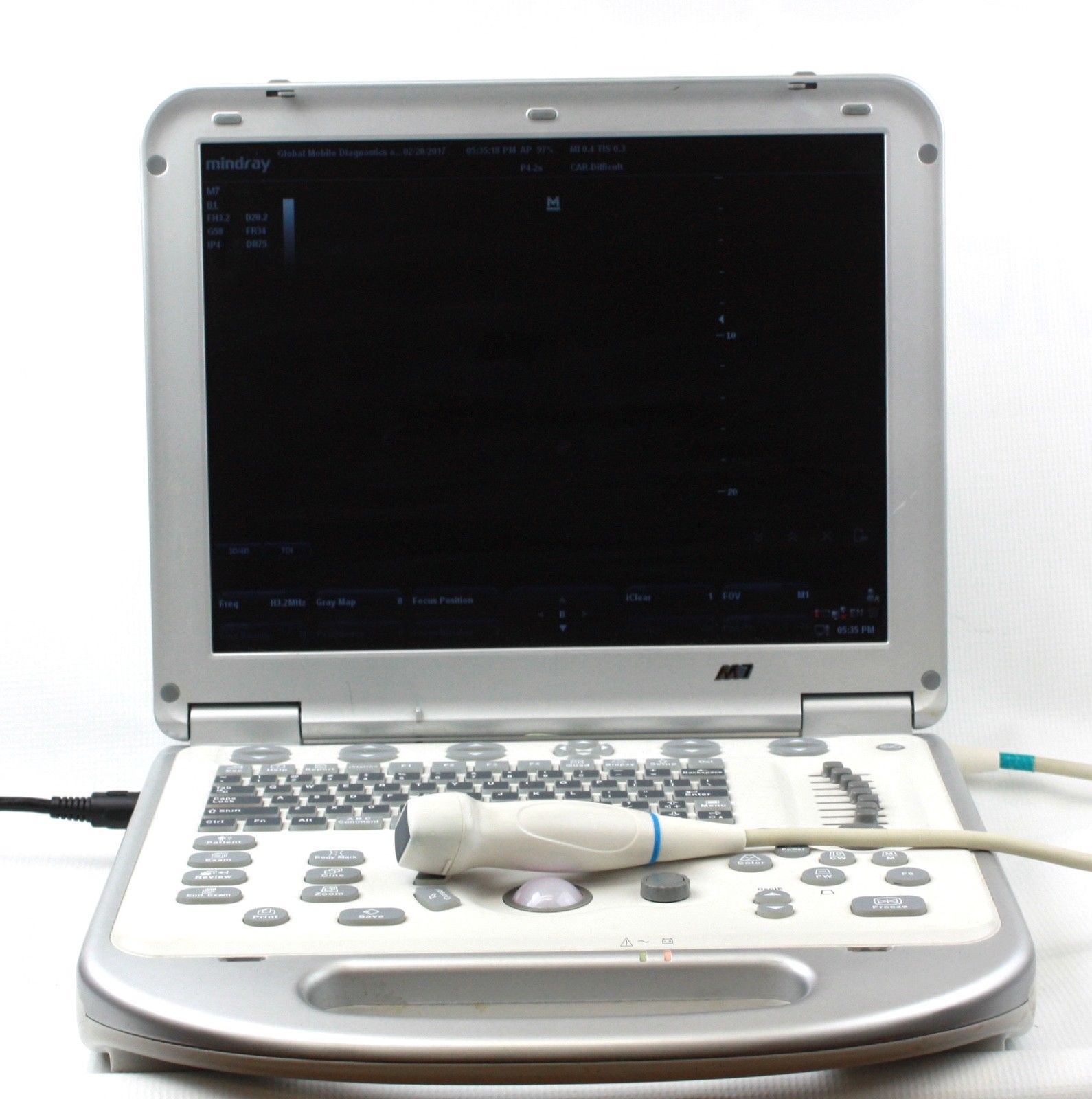 Advanced Cardiac Ultrasound with CW and phased array probe DIAGNOSTIC ULTRASOUND MACHINES FOR SALE