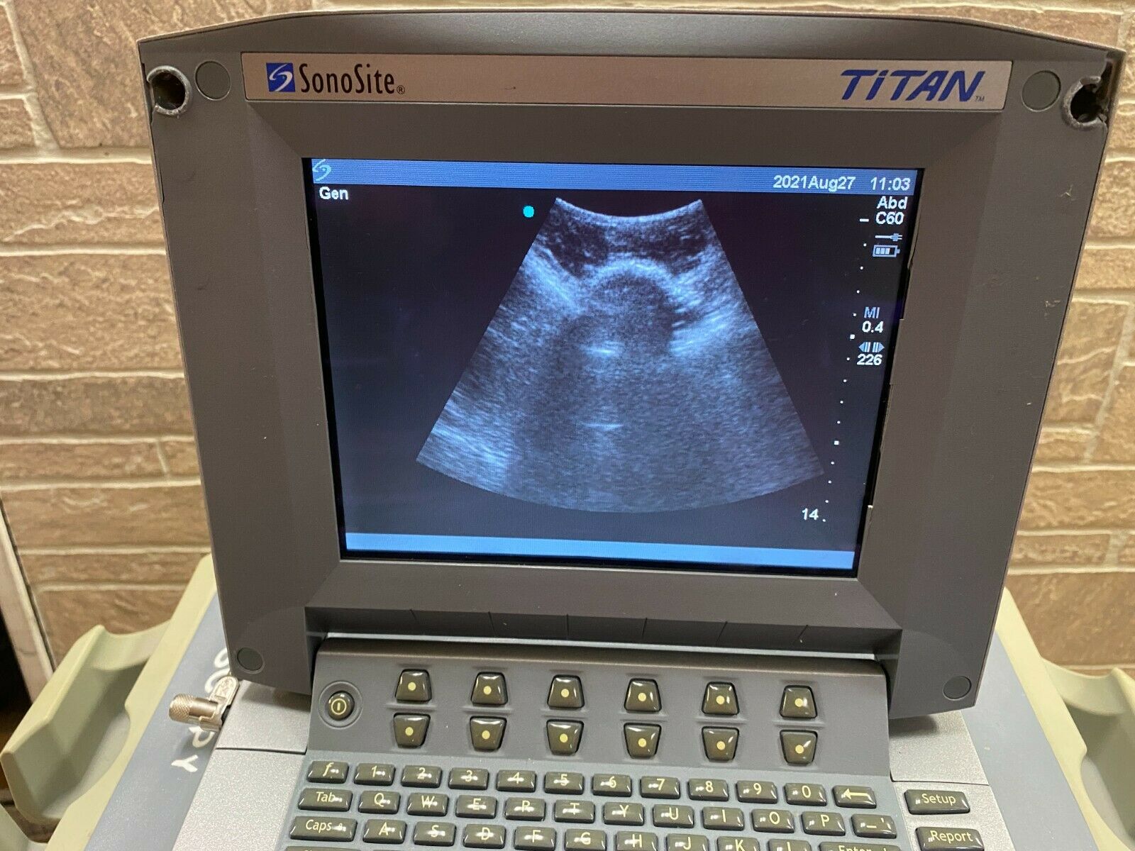 SONOSITE TITAN PORTABLE ULTRASOUND MACHINE WITH 1 PROBE (C60) DIAGNOSTIC ULTRASOUND MACHINES FOR SALE