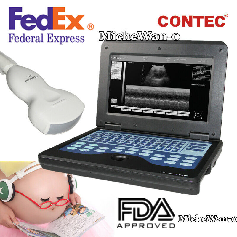 Ultrasound Scanner Laptop Digital Abdominal Diagnostic Machine 3.5 Convex USA 658126883672 DIAGNOSTIC ULTRASOUND MACHINES FOR SALE