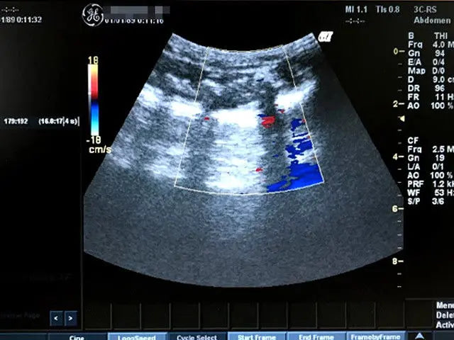 GE LOGIQ BOOK XP  ULTRASOUND WITH  3-PROBE DIAGNOSTIC ULTRASOUND MACHINES FOR SALE