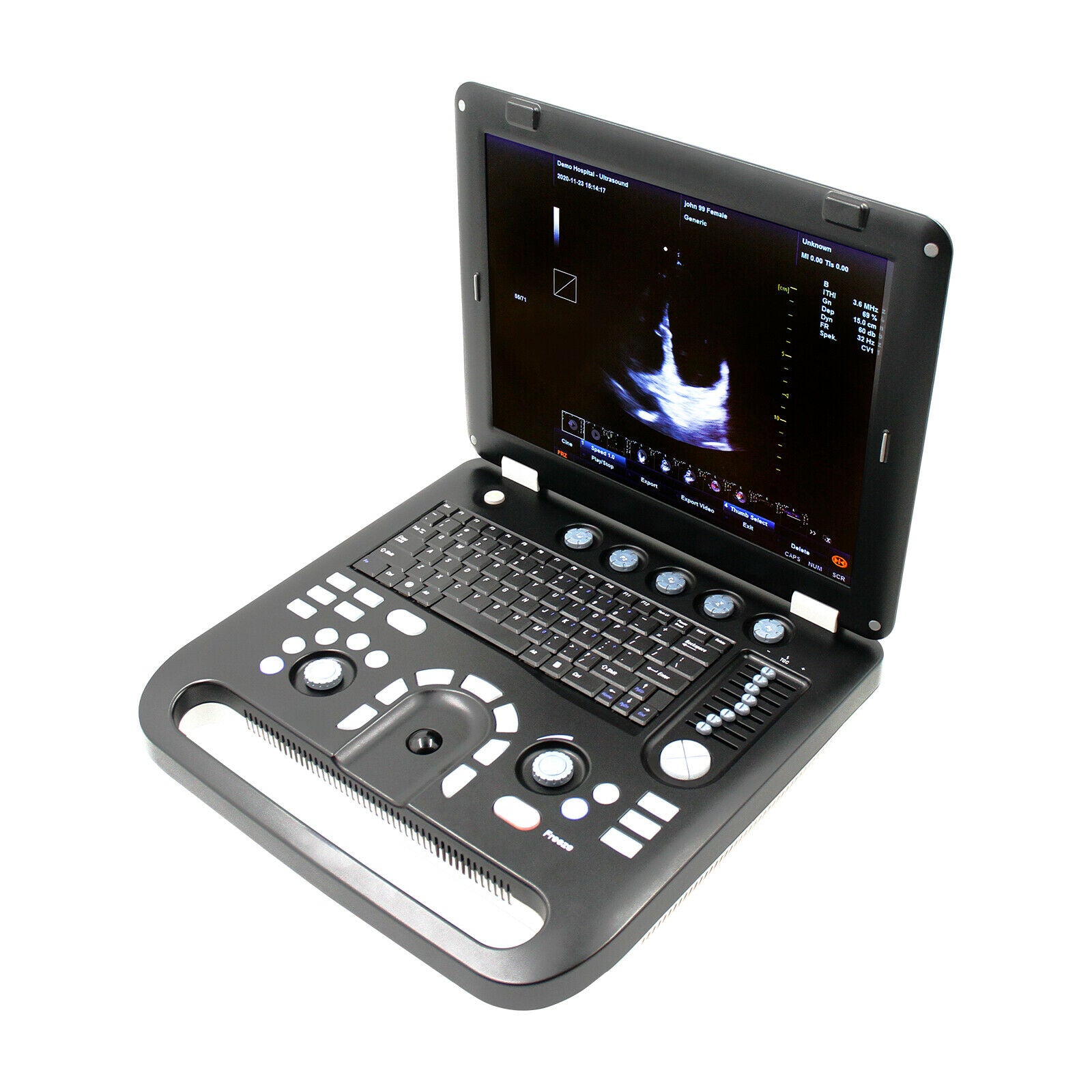 Portable Ultrasound Scanner Color Doppler Machine+ Convex Probe, PW CW,USB+Video DIAGNOSTIC ULTRASOUND MACHINES FOR SALE