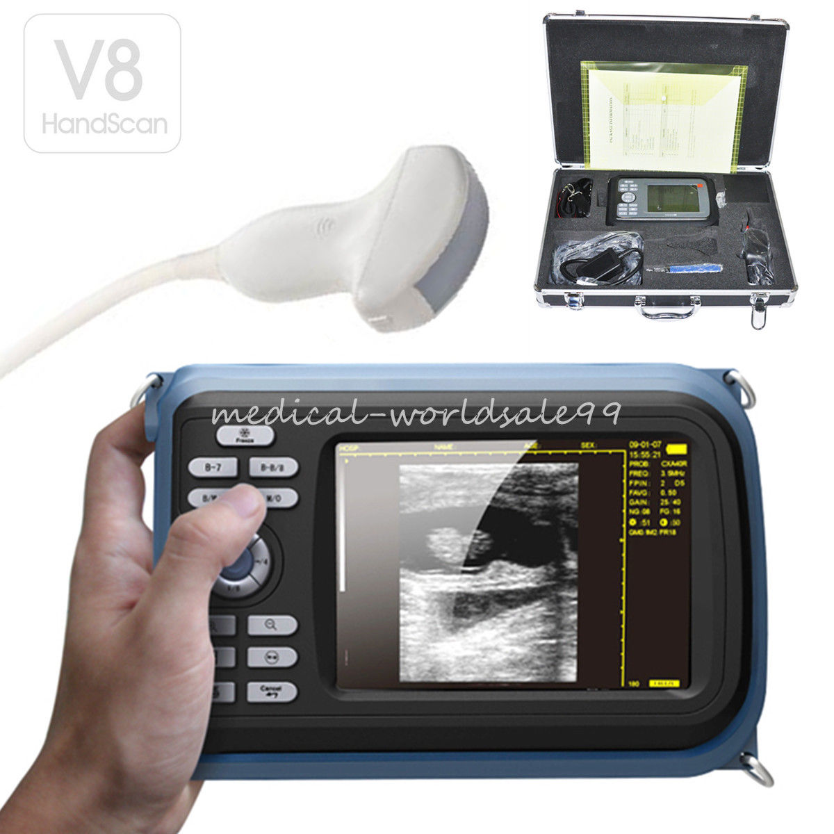 Handheld Smart Ultrasound Scanner Machine +Micro-Convex Probe w Box VET Aminal 190891596901 DIAGNOSTIC ULTRASOUND MACHINES FOR SALE