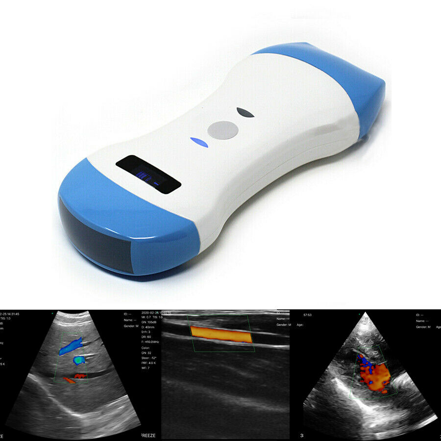 Wireless Dual Head Ultrasound Probe - Portable Color Scanner-Linear Convex probe DIAGNOSTIC ULTRASOUND MACHINES FOR SALE