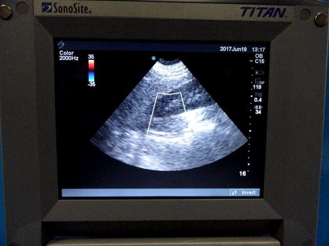 2008 Sonosite C15 / 4-2 MHz Convex Array Probe for Sonosite Titan 180 Plus~12892 DIAGNOSTIC ULTRASOUND MACHINES FOR SALE