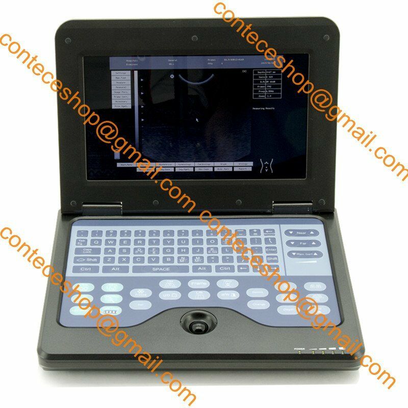 Cat/dog/pet VET Digital Ultrasound Scanner laptop Machine, micro convex, Animals 658126883672 DIAGNOSTIC ULTRASOUND MACHINES FOR SALE