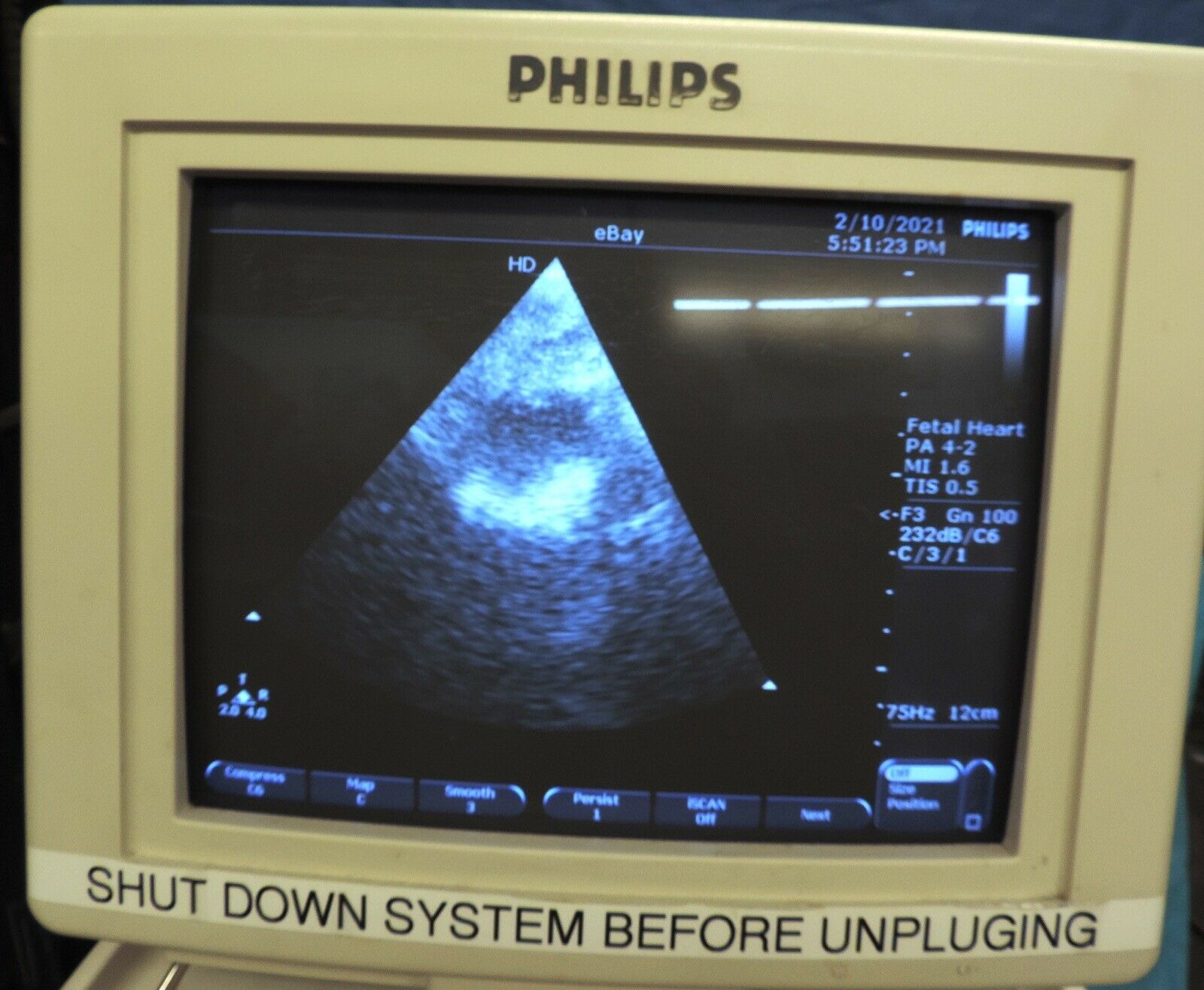 Philips EnVisor C M2540A HD CHD Ultrasound Machine System w/ Probes Transducers DIAGNOSTIC ULTRASOUND MACHINES FOR SALE