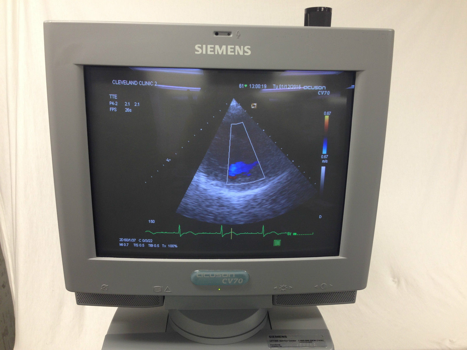 Siemens Acuson CV70 Cardiac Vascular Ultrasound Machine. L10-5 P4-2 Included DIAGNOSTIC ULTRASOUND MACHINES FOR SALE