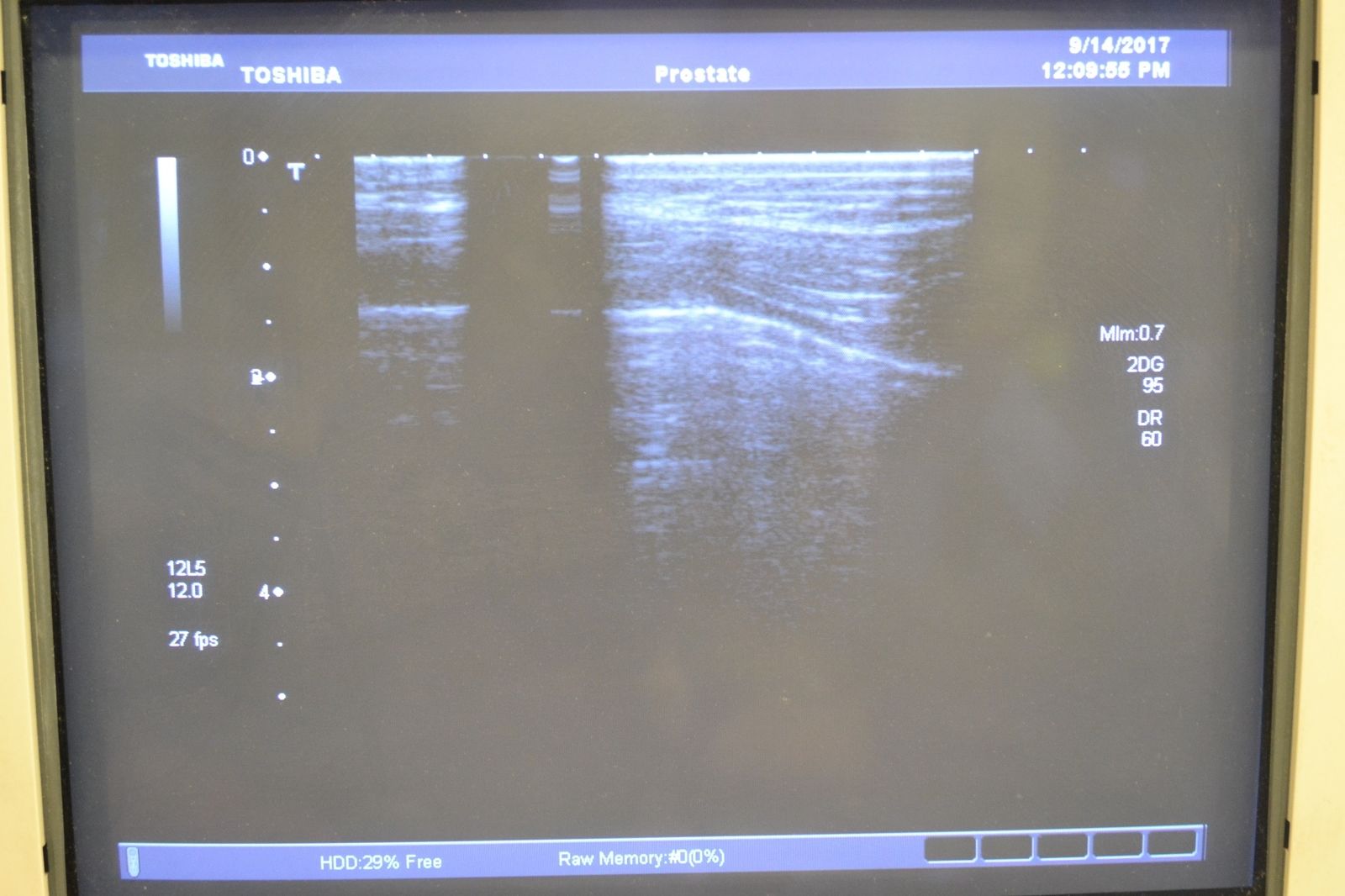 Toshiba Viamo PLT-805AT 12-6.2MHz Linear Ultrasound Transducer Probe DIAGNOSTIC ULTRASOUND MACHINES FOR SALE