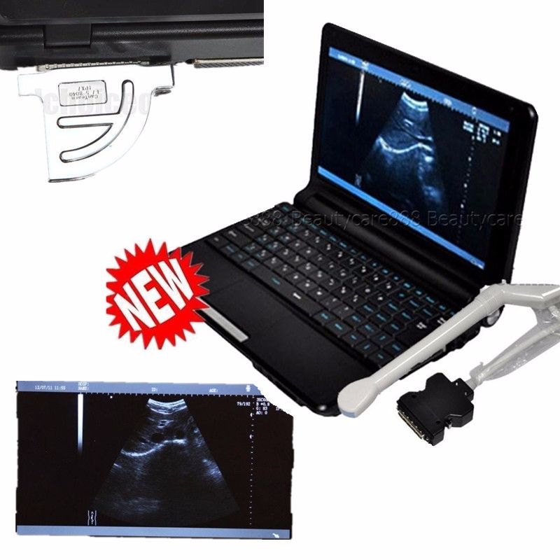 Top Laptop Ultrasound Machine Ultrasound Scanner 6.5 MHZ Transvaginal Probe + 3D DIAGNOSTIC ULTRASOUND MACHINES FOR SALE