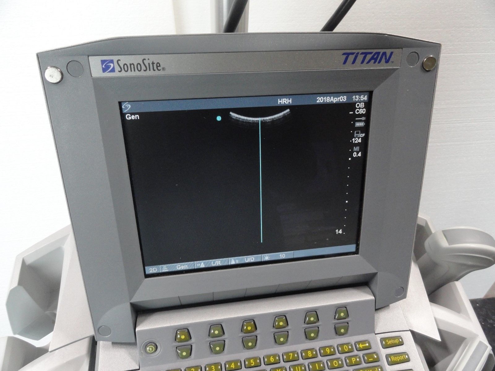 Sonosite Titan Portable Ultrasound Loaded unit with 3 probes transducers DIAGNOSTIC ULTRASOUND MACHINES FOR SALE