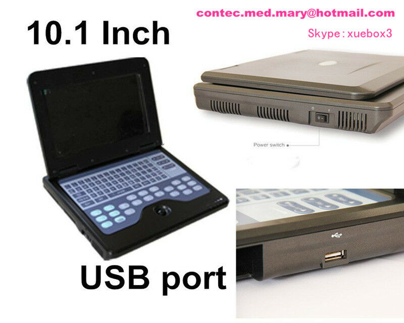 US seller Digital Ultrasound Scanner Laptop Machine with CONVEX+Linear 2 Probes DIAGNOSTIC ULTRASOUND MACHINES FOR SALE