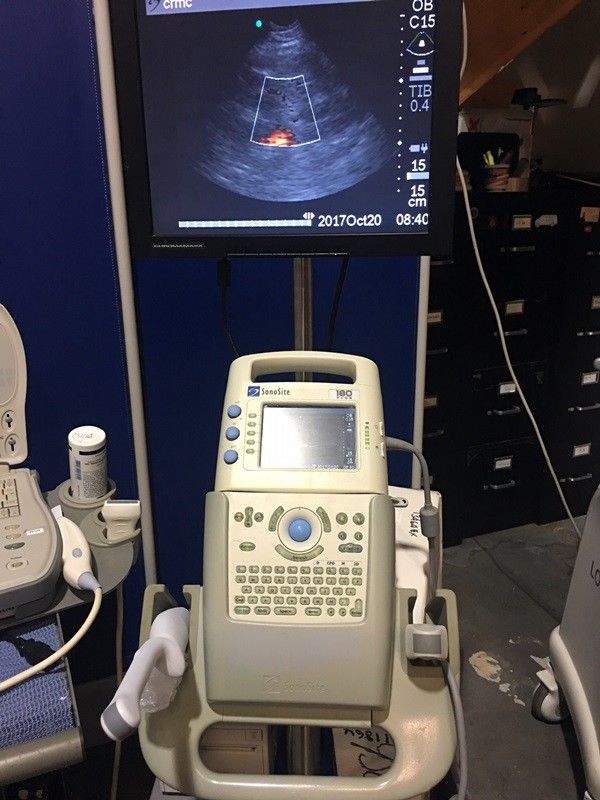 Sonosite 180 Plus ultrasound with docking unit aux. monitor and 2 Probes DIAGNOSTIC ULTRASOUND MACHINES FOR SALE