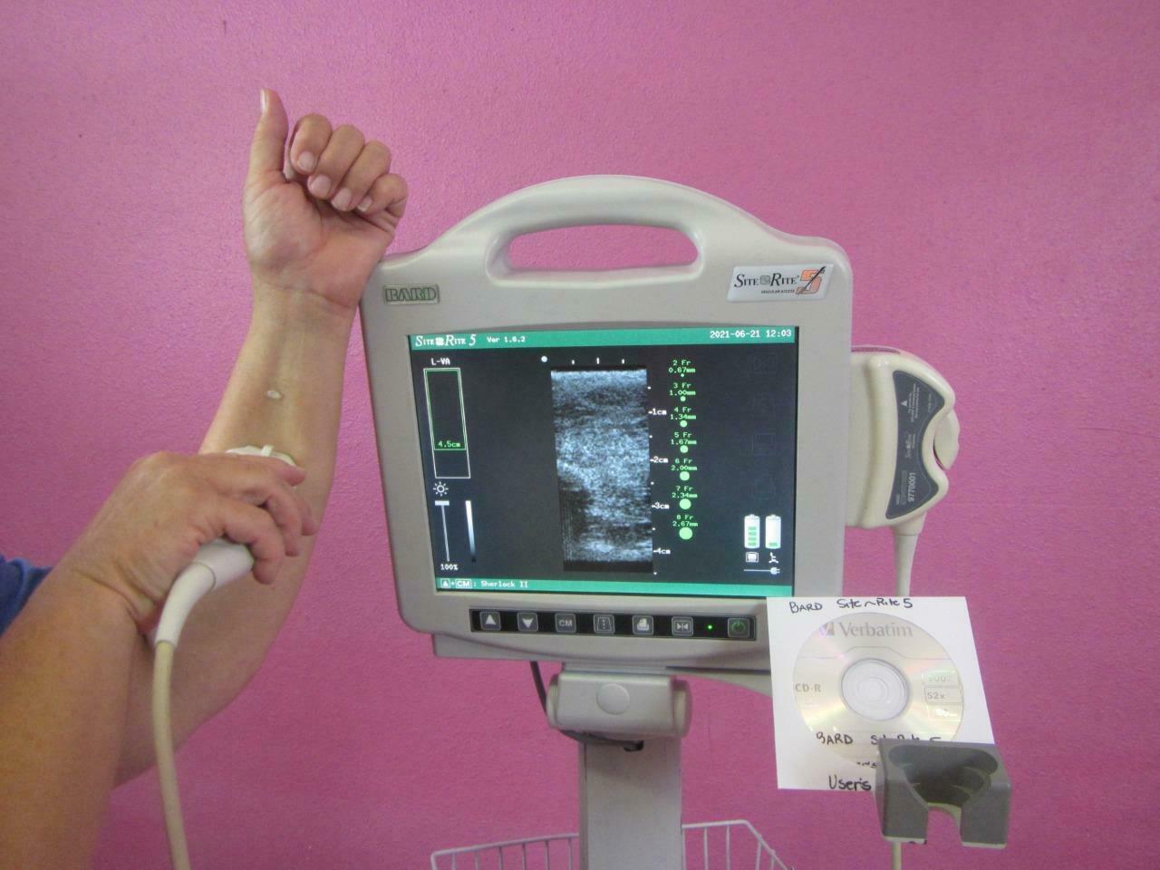 Bard Site Rite 5 Ultrasound Machine, Vascular Access Probe, Sherlock 2 Software DIAGNOSTIC ULTRASOUND MACHINES FOR SALE