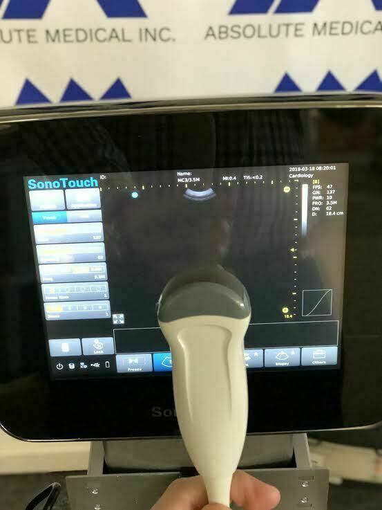 Chison Sonotouch 30 Touch Screen Portable Ultrasound Machine with Three Probes! DIAGNOSTIC ULTRASOUND MACHINES FOR SALE