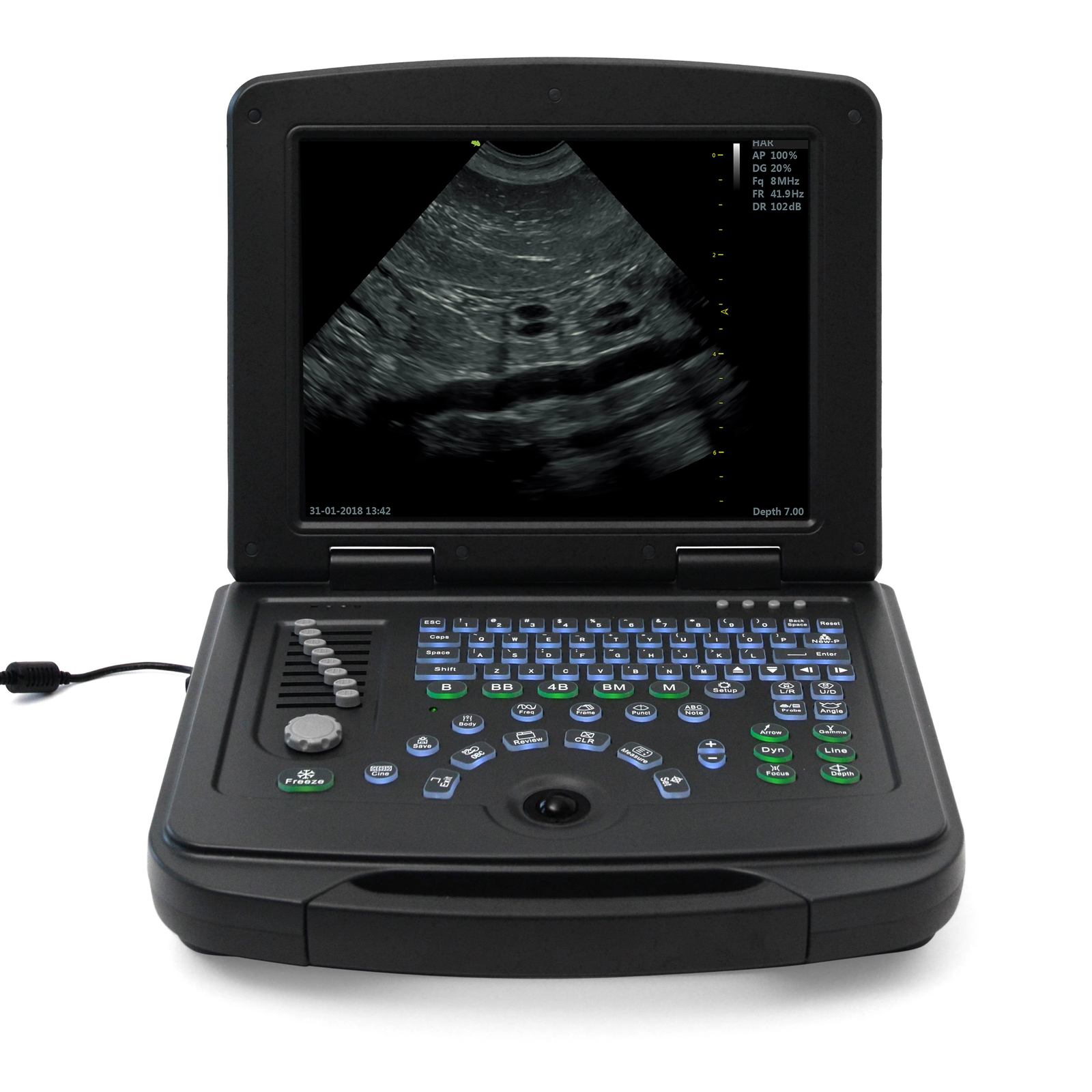 SmartBook™ Veterinary Grade 4K Portable Ultrasound Scanner Laptop for Dog & Cat DIAGNOSTIC ULTRASOUND MACHINES FOR SALE