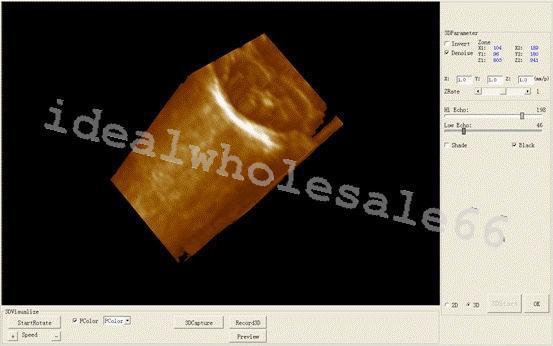 Digital Laptop Ultrasonic Ultrasound Scanner/Machine 7.5M Vascular Linear Probe DIAGNOSTIC ULTRASOUND MACHINES FOR SALE