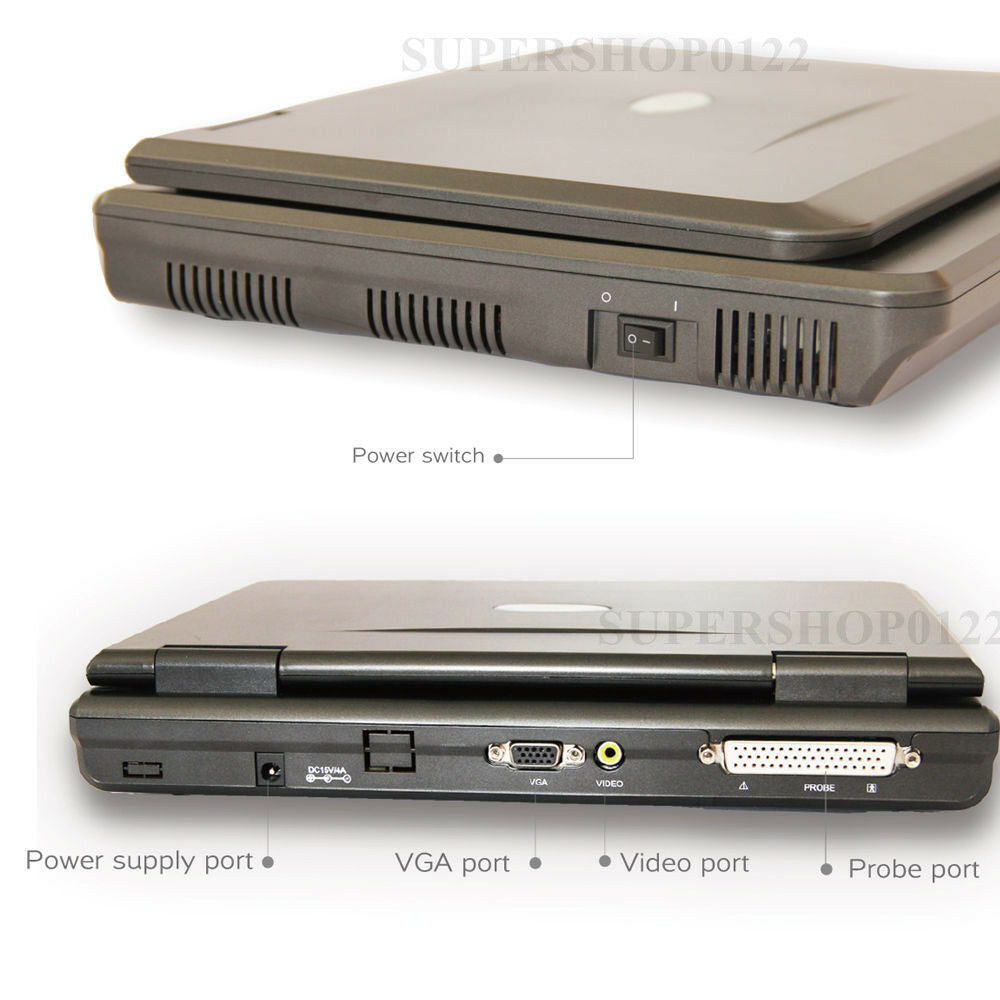 Portable Laptop Ultrasound machine Scanner micro-convex probe CardiacTransducer  658126669122 DIAGNOSTIC ULTRASOUND MACHINES FOR SALE