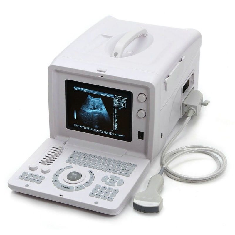 Ultrasonic Ultrasound Scanner Ultrasound Scanning+7.5Mhz Linear Array  probe  CE DIAGNOSTIC ULTRASOUND MACHINES FOR SALE