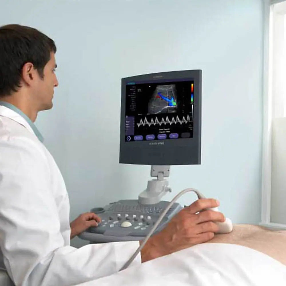 Siemens Acuson Ultrasound System - X150 Scan Machine with Color Dopp & Box Only DIAGNOSTIC ULTRASOUND MACHINES FOR SALE