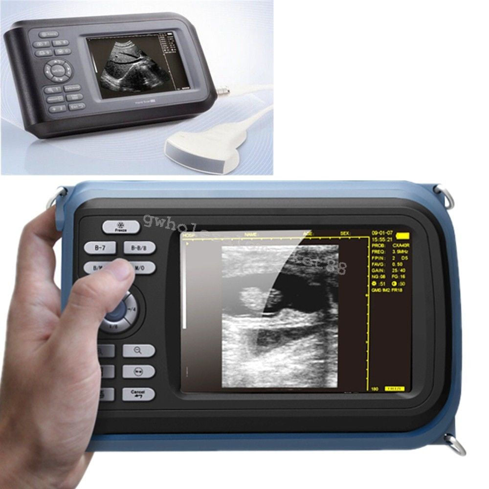 US Laptop Machine Digital Ultrasound Scanner Convex + Linear+ Transvaginal Probe 190891696984 DIAGNOSTIC ULTRASOUND MACHINES FOR SALE