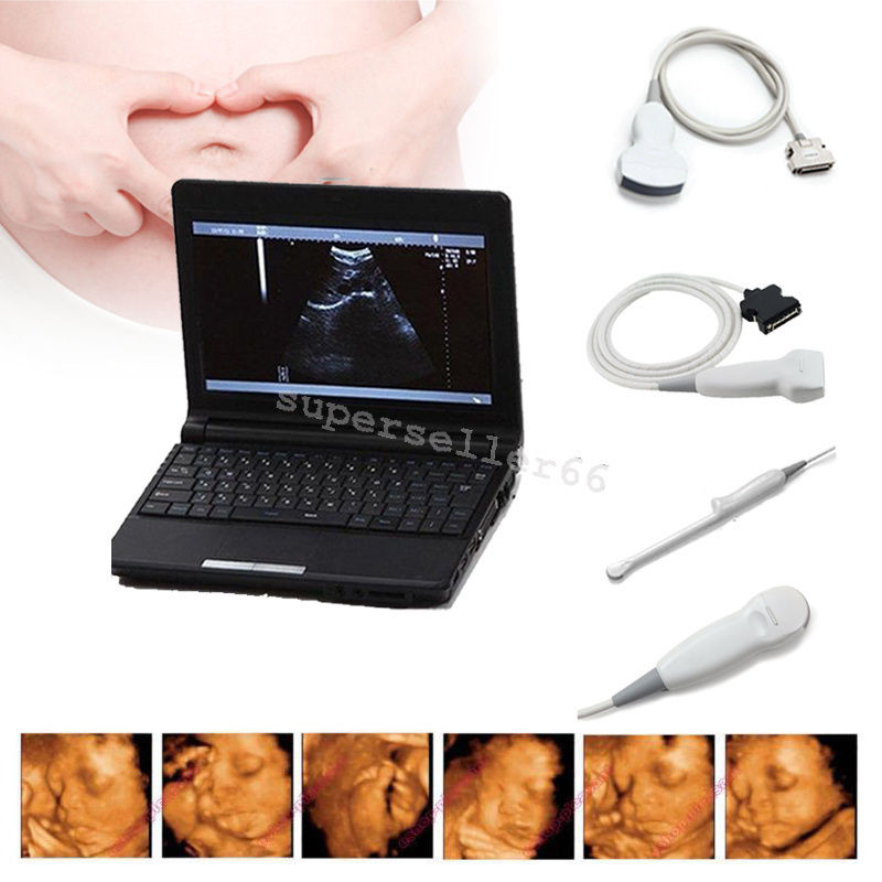 Ultrasound Scanner Monitoring+Convex,Linear,Trans Vaginal,Micro-convex 4 Probes DIAGNOSTIC ULTRASOUND MACHINES FOR SALE