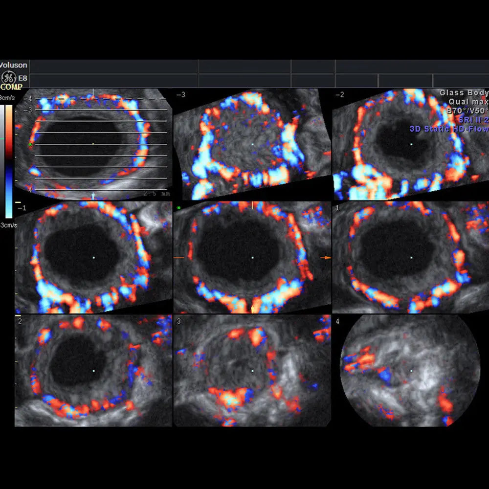 Voluson E8 Machine - GE Ultrasound - Routine to Complex Women’s Health Exams DIAGNOSTIC ULTRASOUND MACHINES FOR SALE