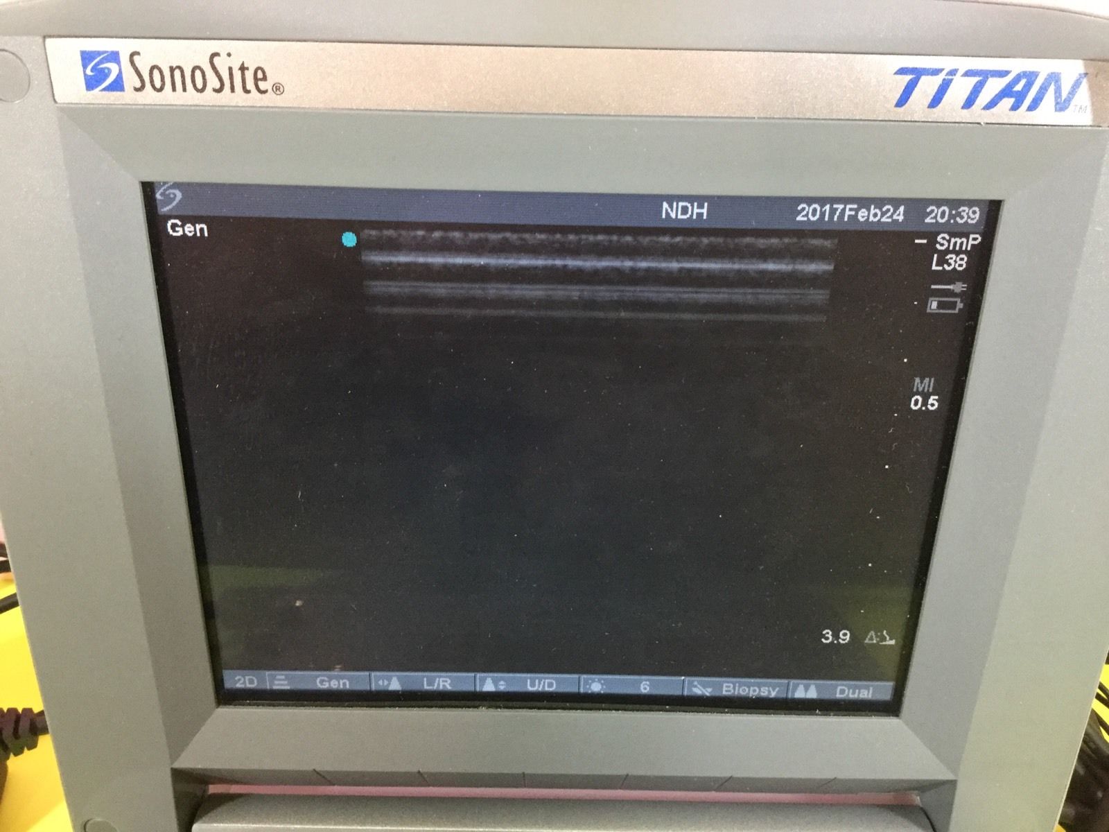 SONOSITE TITAN Portable Ultrasound with C15/4-2 and L38/10-5 Transducers DIAGNOSTIC ULTRASOUND MACHINES FOR SALE