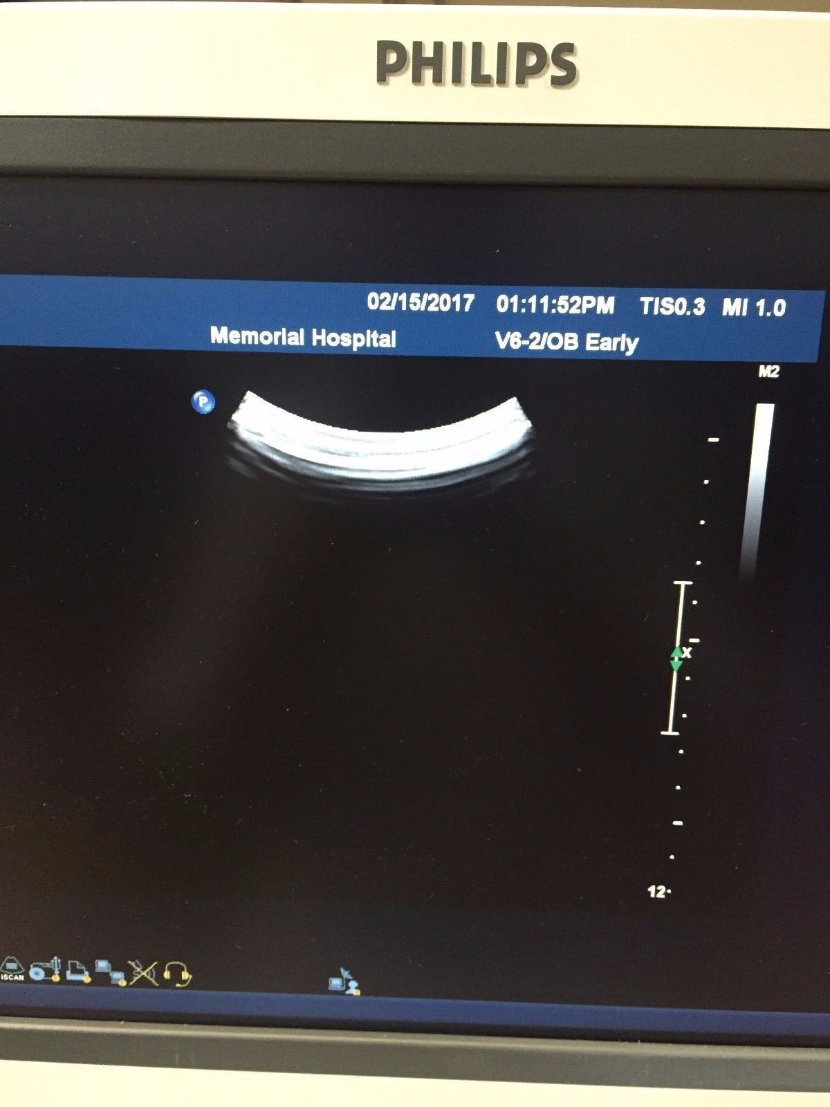 Philips V6-2 Curved Volume Array  Ultrasound Transducer  for Philips iU22 DIAGNOSTIC ULTRASOUND MACHINES FOR SALE