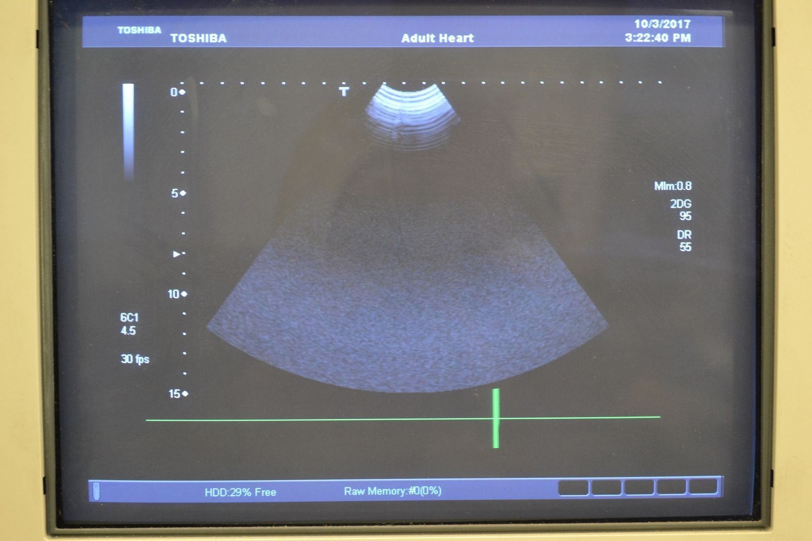 Toshiba Viamo PVT-382BT 5.5-1.8MHz Convex Ultrasound Transducer Probe J1641 DIAGNOSTIC ULTRASOUND MACHINES FOR SALE