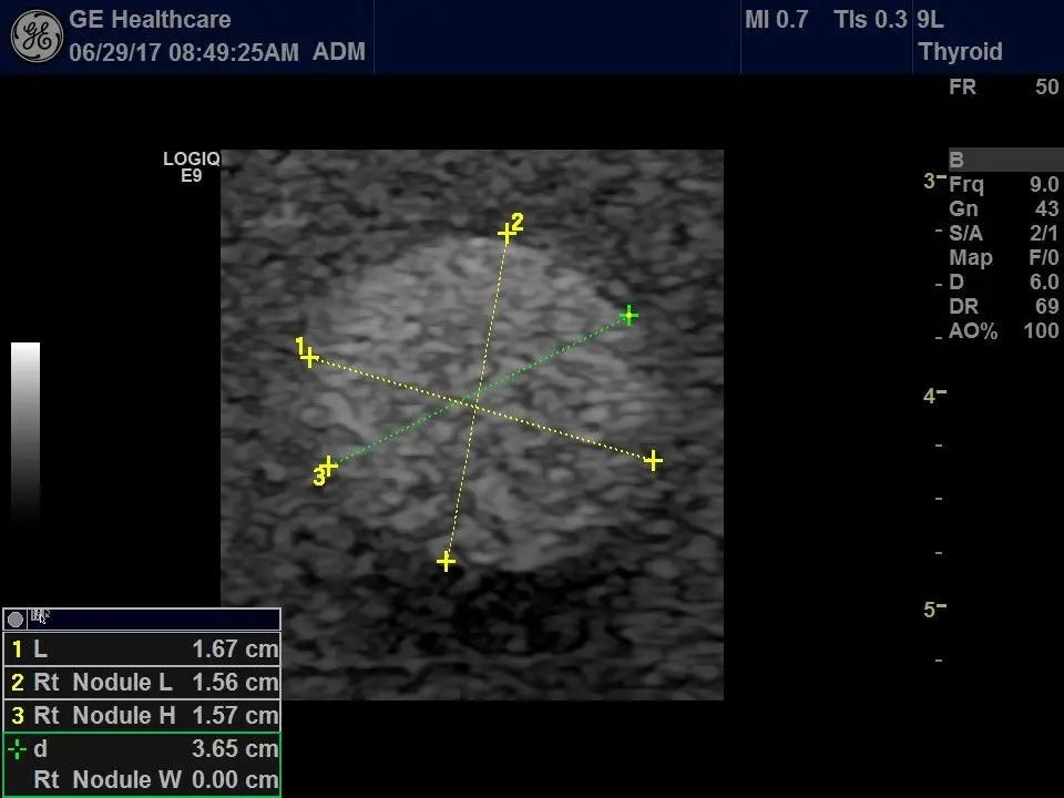 GE Logiq E9 with XDclear Ultrasound System DIAGNOSTIC ULTRASOUND MACHINES FOR SALE