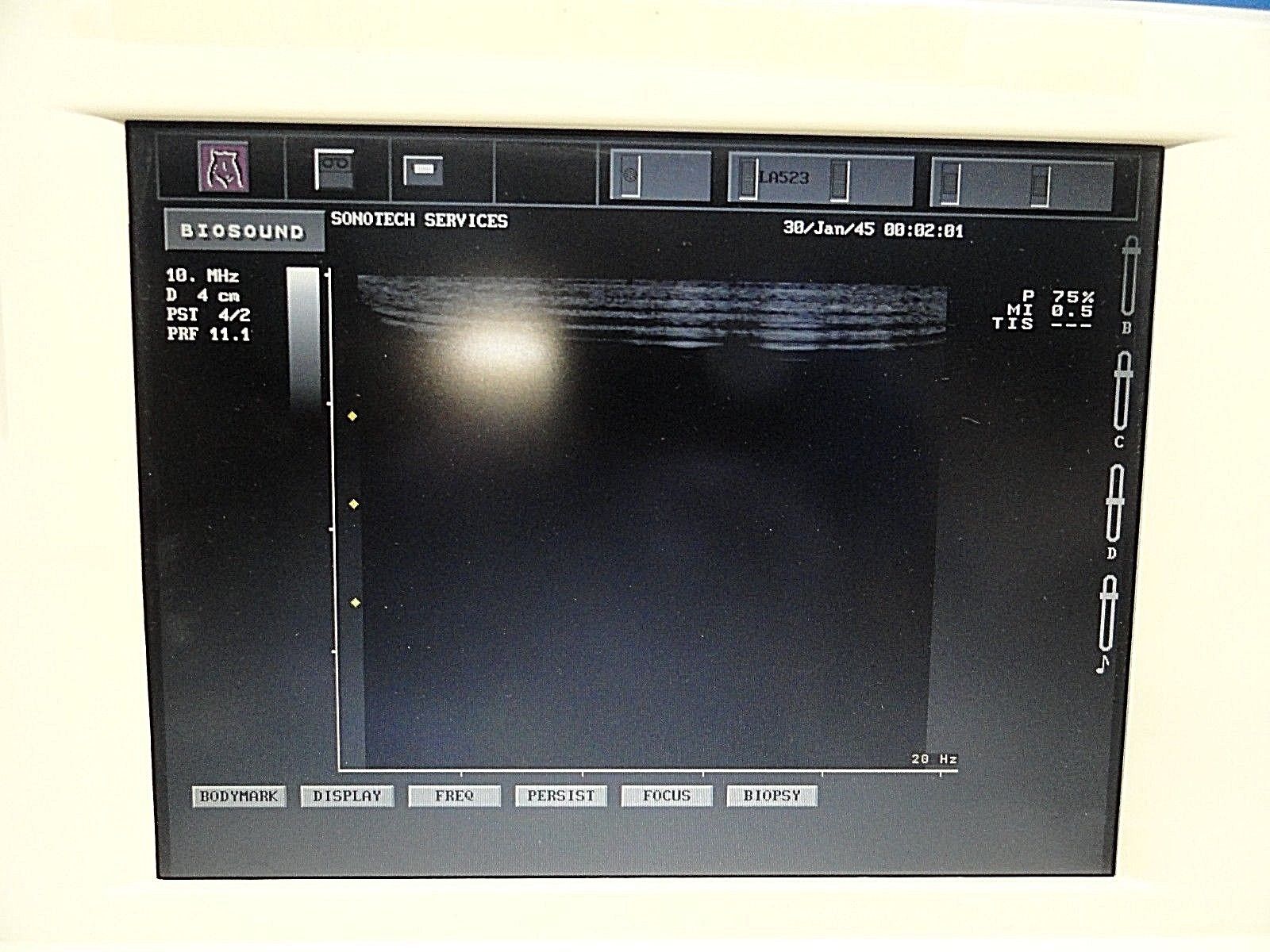 Biosound ESAOTE LA523 10-5 MHz Linear Array Ultrasound Transducer ~ 14901 DIAGNOSTIC ULTRASOUND MACHINES FOR SALE