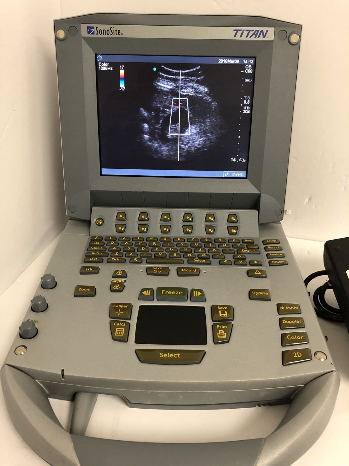 SONOSITE TITAN Ultrasound With C60/5-2 Convex Array Probe And Power Supply DIAGNOSTIC ULTRASOUND MACHINES FOR SALE