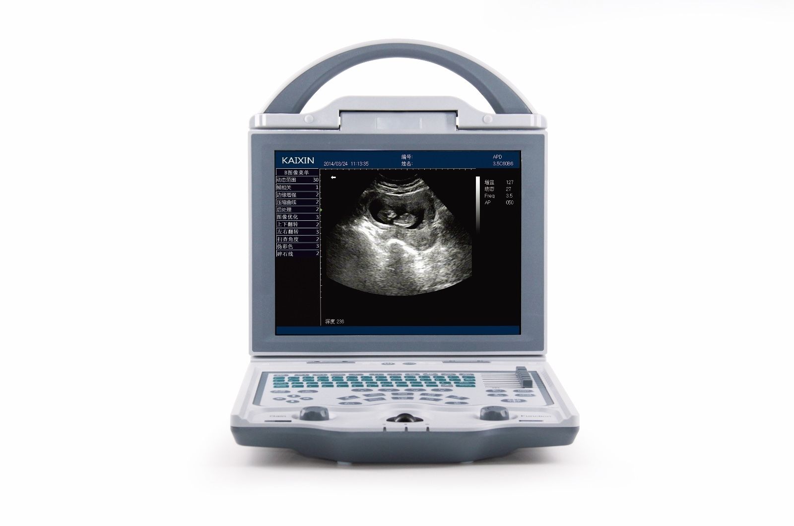 Veterinary Small Animal Ultrasound Scanner&Micro-Convex Probe 5-8Mhz--KX5600V DIAGNOSTIC ULTRASOUND MACHINES FOR SALE