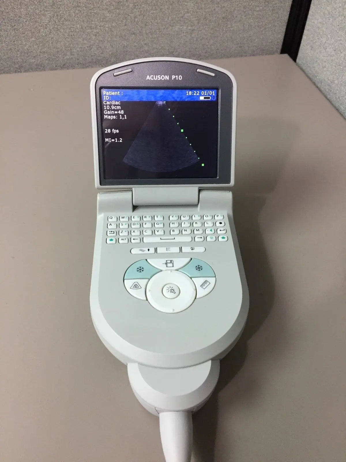 SIEMENS ACUSON P10 PORTABLE ULTRASOUND  SYSTEM DIAGNOSTIC ULTRASOUND MACHINES FOR SALE