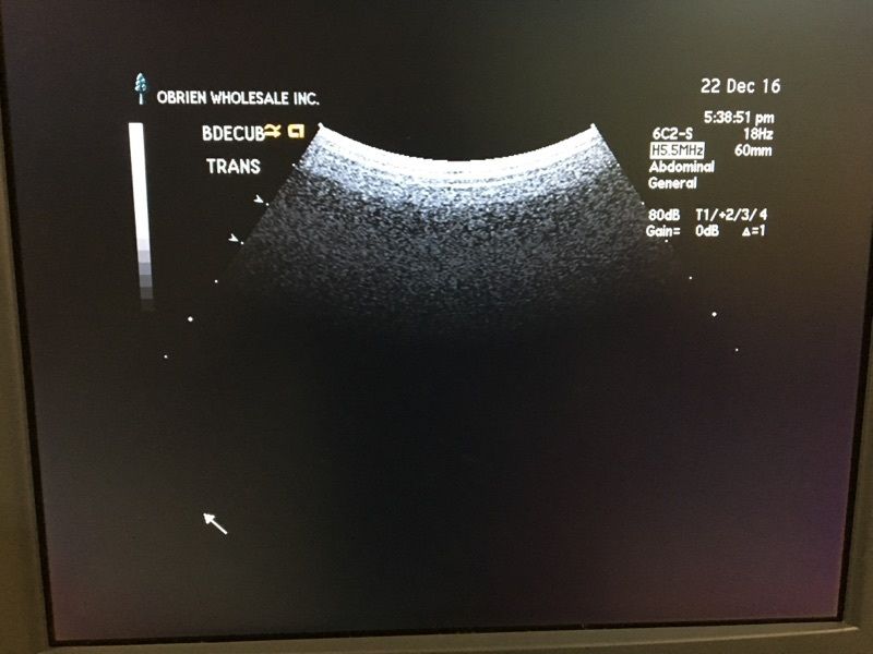 Siemens Sequoia Acuson 512 Cardiac Ultrasound w/ 4V1 6C2 EV-8C4 Transducer DIAGNOSTIC ULTRASOUND MACHINES FOR SALE