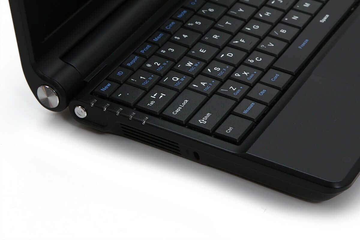 Portable Ultrasonic Ultrasound Scanner Digital Laptop Machine 3.5MHz ConvexProbe DIAGNOSTIC ULTRASOUND MACHINES FOR SALE