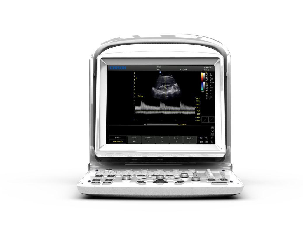 Chison ECO3, MSK, Tendon, Vascular Black/White Ultrasound Machine & Linear Probe DIAGNOSTIC ULTRASOUND MACHINES FOR SALE