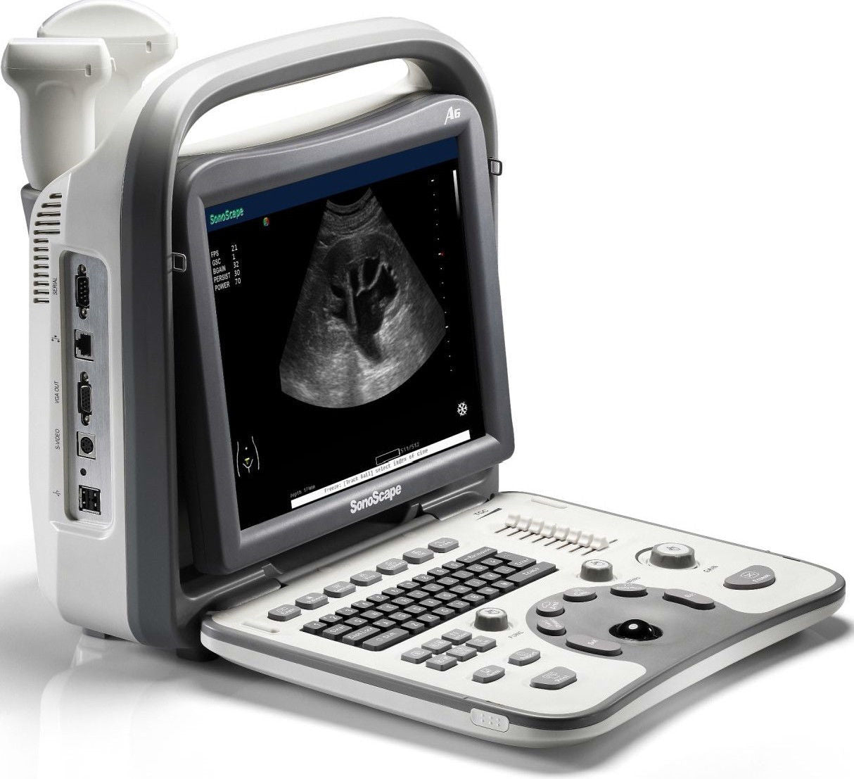 SonoScape A6V Veterinary Ultrasound Scanner - Convex Probe 5-9MHz, Trolley, Bag DIAGNOSTIC ULTRASOUND MACHINES FOR SALE